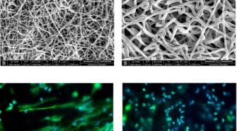 Fiber diameter of electrospun templates regulates in vitro NETosis