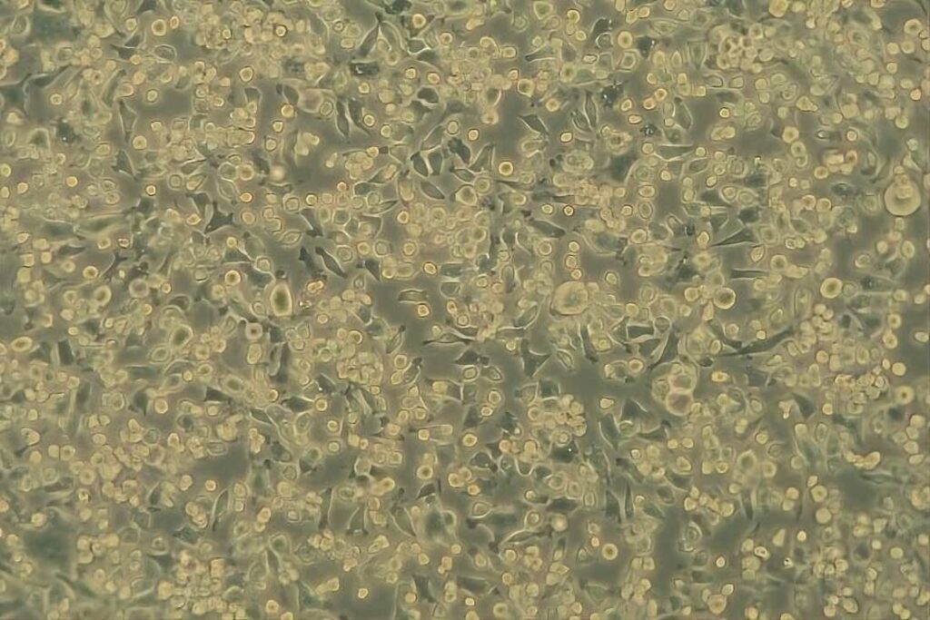 Intact host cells (NCTC) before virus contact (100x). Photo courtesy of DITF