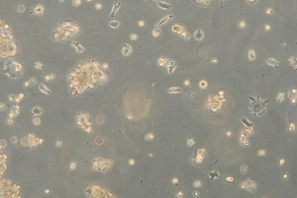 Cytopathic effects on host cells by viruses (100x). Photo courtesy of DITF